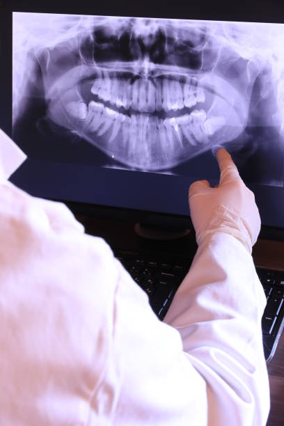 Best Broken or Cracked Tooth Emergency Dentist in Moses Lake, WA